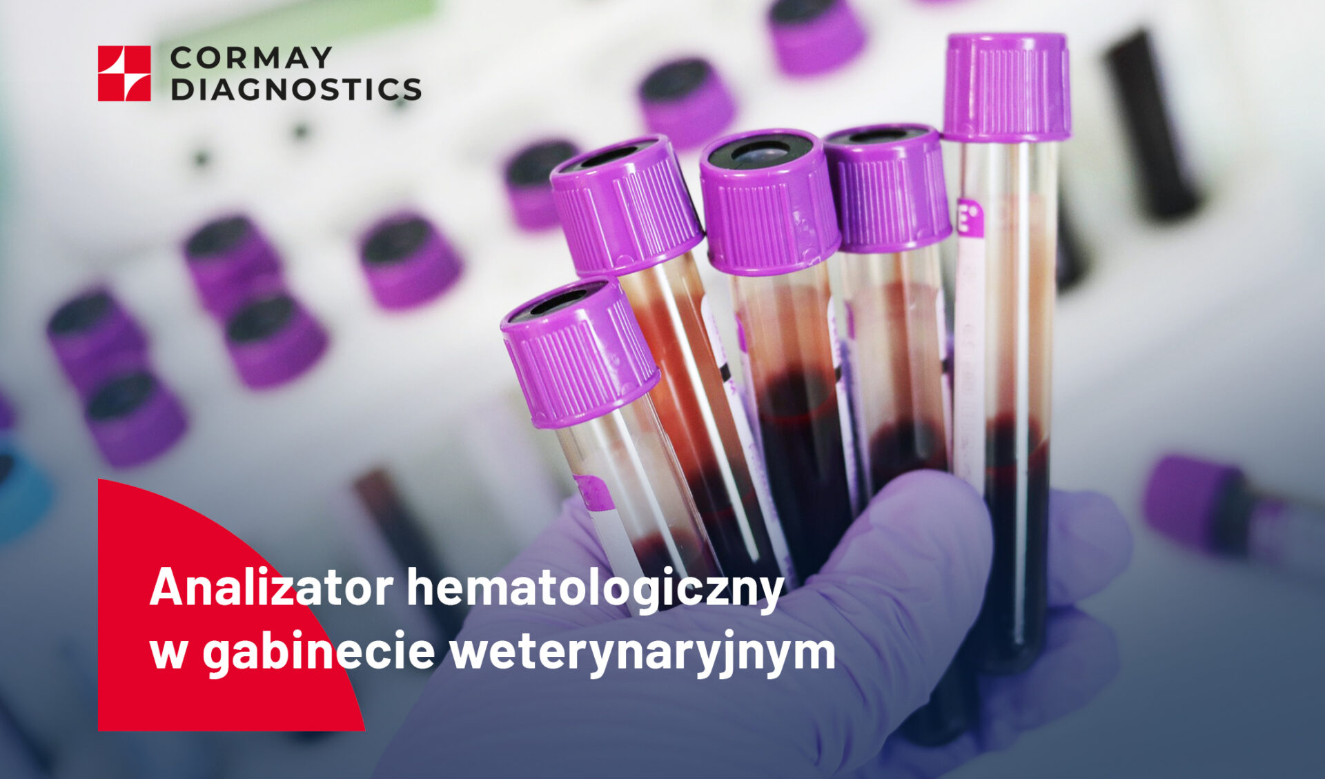 Hematologia – analizator w gabinecie, czy badania w laboratorium zewnętrznym?